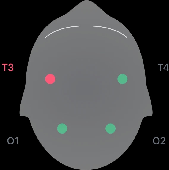 A diagram of the sensor cap's four electrode positions: T3 and T4 at the temples, O1 and O2 at the back of the head.